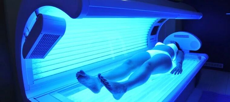 Vene varicose e solarium