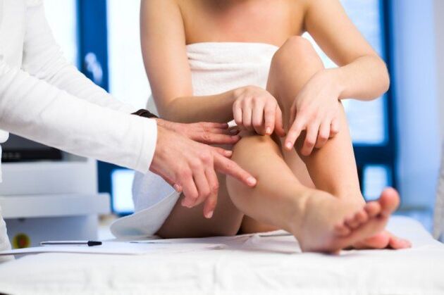 Il medico esamina le gambe per le vene varicose